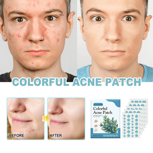 Blue Acne Patch Gentle Deep Cleaning